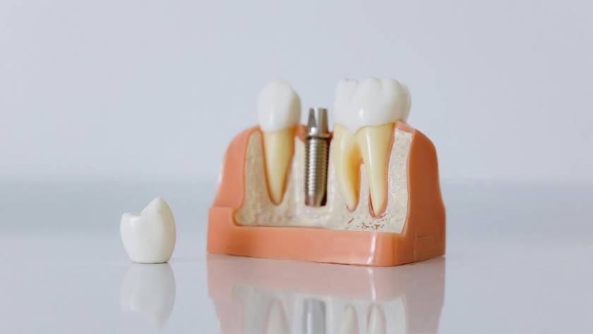 dentista en Móstoles