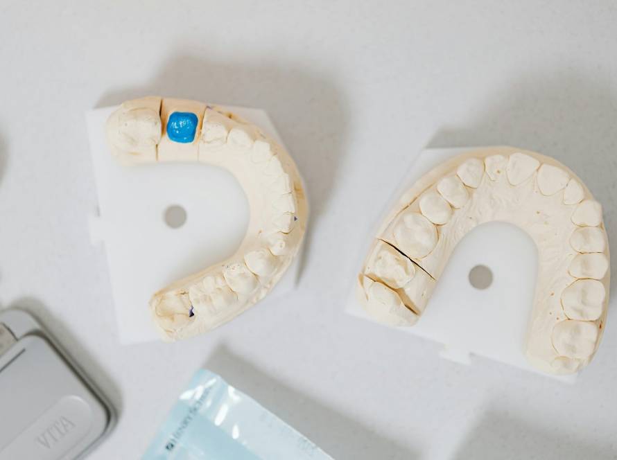 Implantes en Móstoles