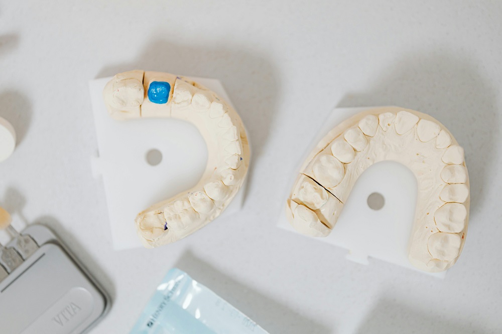 Implantes en Móstoles