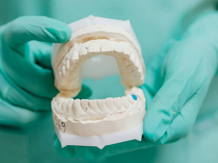 IMPLANTES DENTALES EN MÓSTOLES