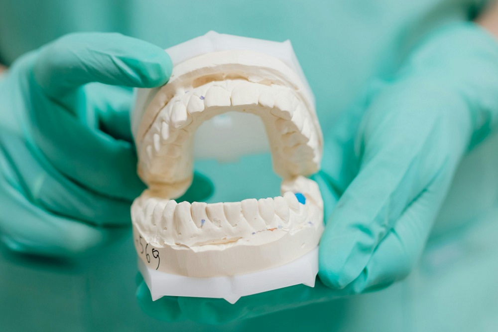 IMPLANTES DENTALES EN MÓSTOLES