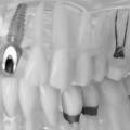 Implantes dentales Móstoles y recupera tu sonrisa con confianza