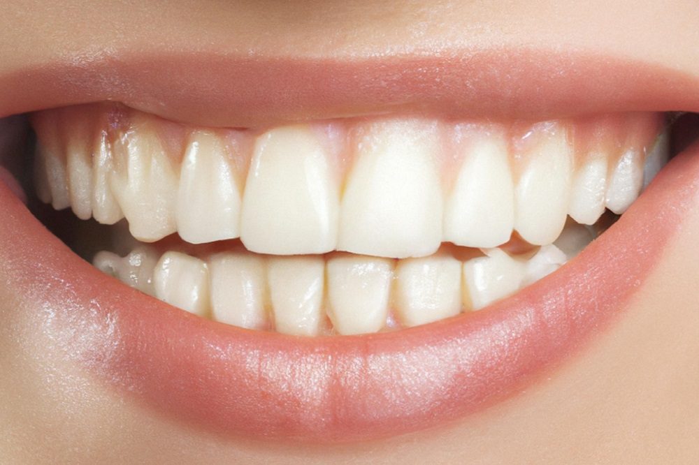 dentista en Móstoles